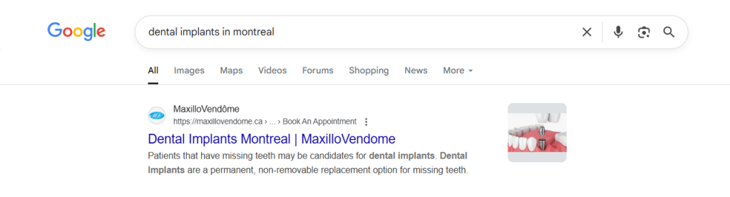 Dental implants search engine marketing screenshot, displaying Montreal clinic ranked #1